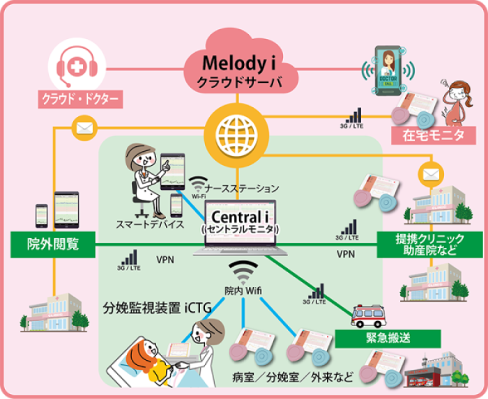 分娩監視セントラルシステム「Central i」で妊婦の状態をいつでもどこでも見守ることができる